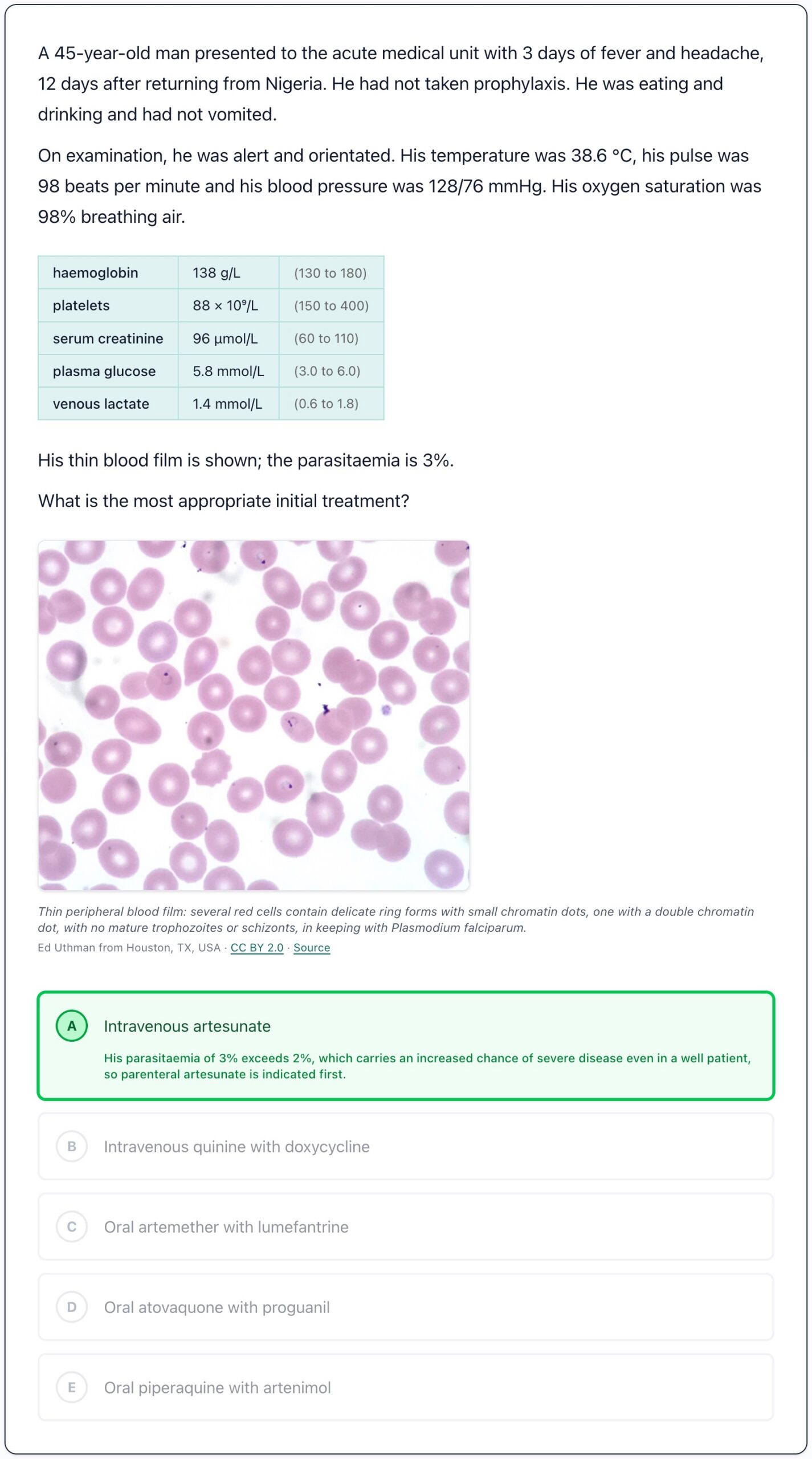 Malaria question with a thin blood film image, answer options and the correct answer explained